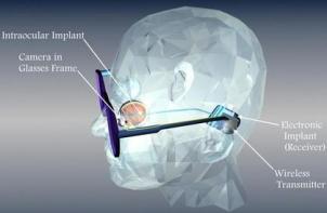 Let There Be Sight! Introducing the Bionic Eye